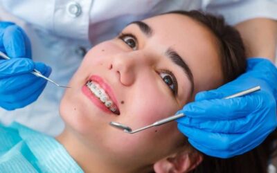 Why are Regular Dental Cleanings Important with Braces?