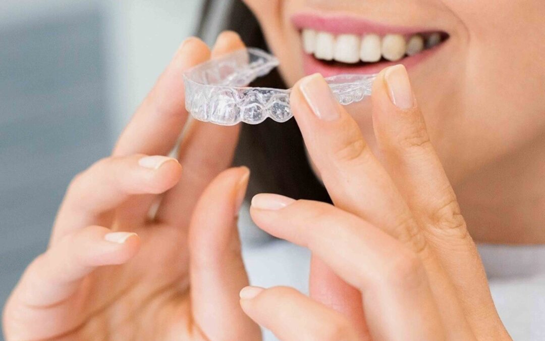 How Long Does It Take Invisalign To Work?