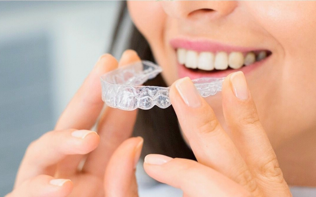Myth vs. Fact: Separating Truth from Fiction in the World of Orthodontics