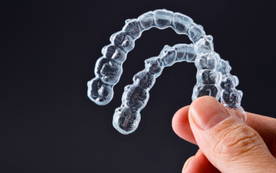 Retainers: The Unsung Heroes of Your Lifelong Smile
