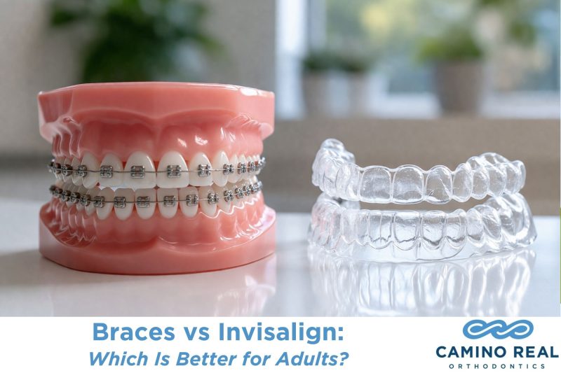 Braces vs Invisalign: Which Is Better for Adults?