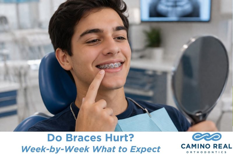 Do Braces Hurt? Week-by-Week What to Expect